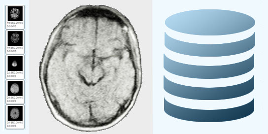 	База медицинских изображений томографа КФТИ